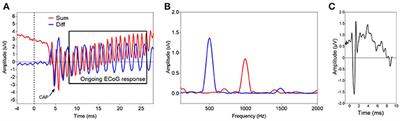 Assessment of Cochlear Function during Cochlear Implantation by Extra- and Intracochlear Electrocochleography